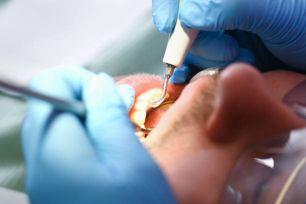 Best Weekend Emergency Dental Services in Taylorsville, KY